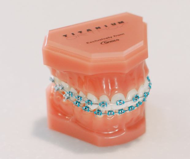 model teeth with braces