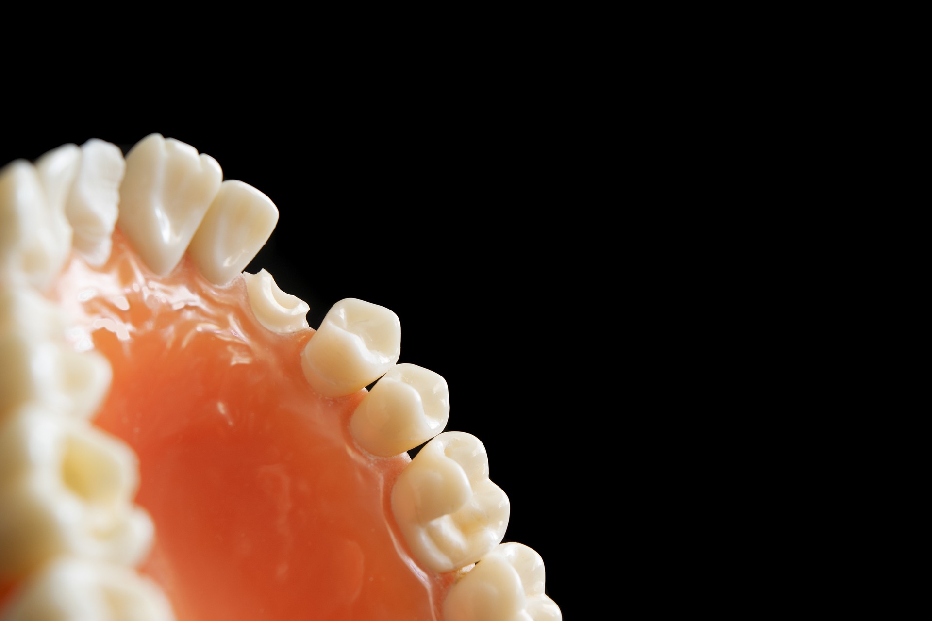 Why You May Need Tooth Contouring in Mint Hill, NC