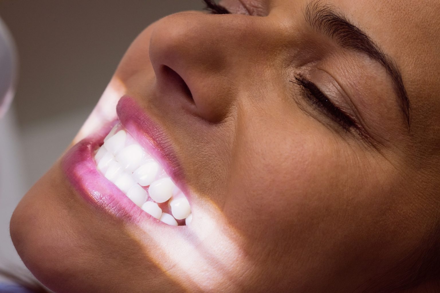 Zoom Whitening